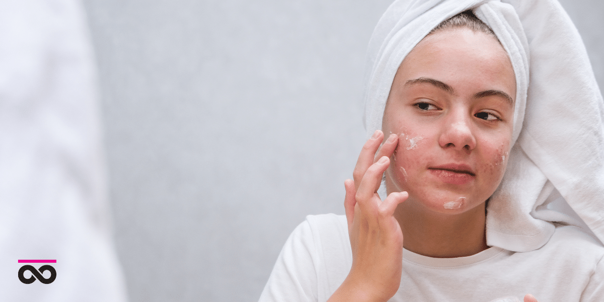 Safe skincare for teens - gentle cleansers and moisturizers: Teen using safe skincare products for young skin